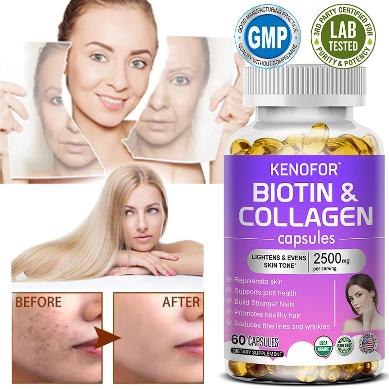 Biotin and Collagen Supplements for Hair Growth - For Hair, Skin and Nails - Anti-Aging